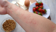 Coping with Allergies: The Promising Role of Vitamin C and Safe Use Tips