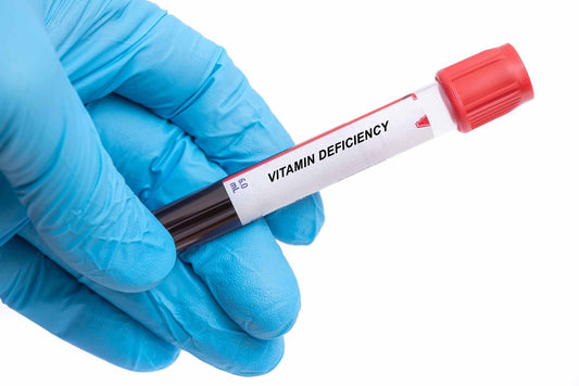 A gloved hand holds a blood sample tube labeled "VITAMIN DEFICIENCY," highlighting the importance of checking for vitamin levels in the body.