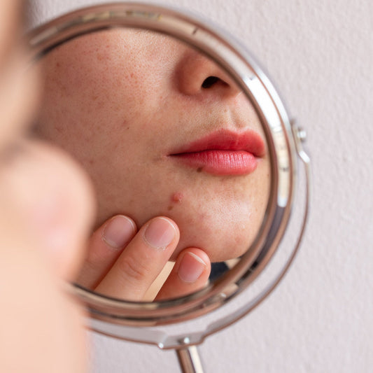 A person examines their face in a mirror, gently touching a small pimple on their chin, highlighting concerns about acne while sitting against a pale background.
