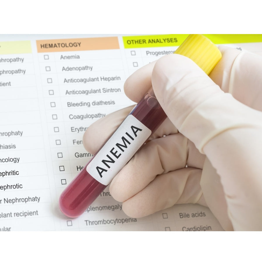 A gloved hand holds a test tube labeled "ANEMIA" above a medical checklist that includes various hematology tests and analyses.
