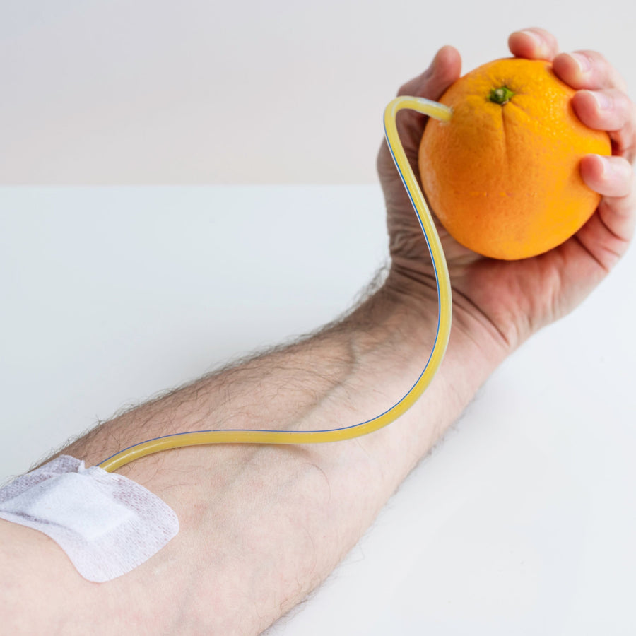 A hand holds an orange while a tube connects it to a bandaged arm, illustrating a creative approach to addressing vitamin C deficiency.