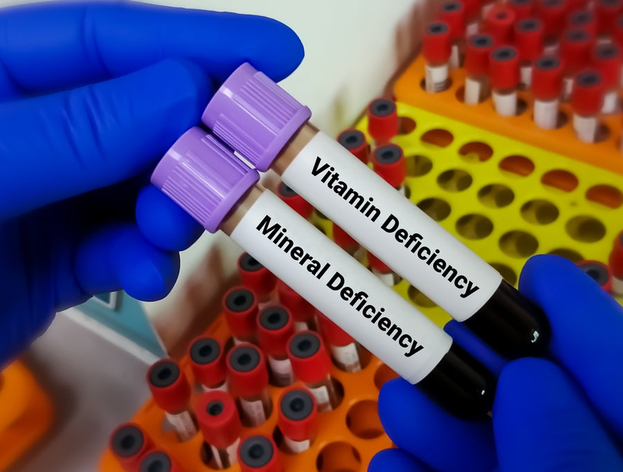 A gloved hand holds two test tubes labeled "Vitamin Deficiency" and "Mineral Deficiency" against a background of multiple blood sample containers in a laboratory setting.