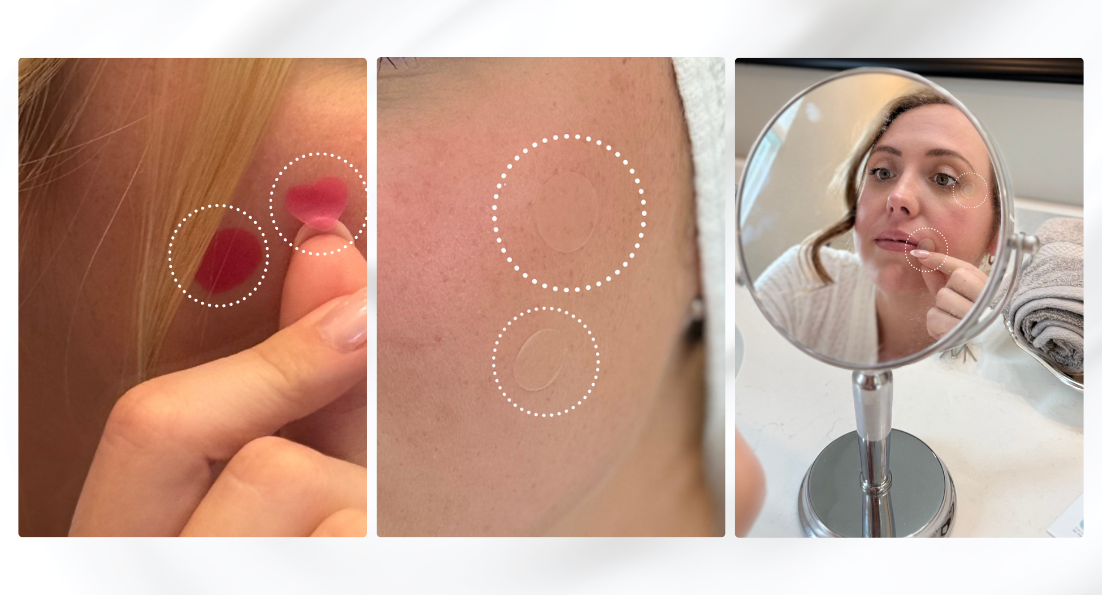 Skincare