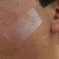 Pimple Patch XL – 10 Extra-Large Hydrocolloid Patches for Face and Body
