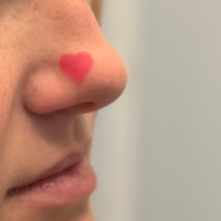 Pimple Patch Hearts – 72 Hydrocolloid Patches in 2 Heart Sizes with Tea Tree Oil