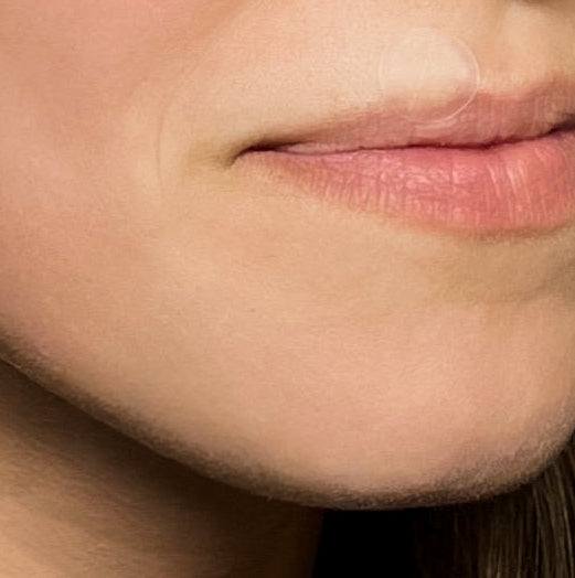 Lip Care Patch