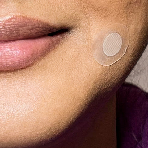 Microneedle Blemish Patch – 9 Patches with Salicylic Acid and Tea Tree Oil