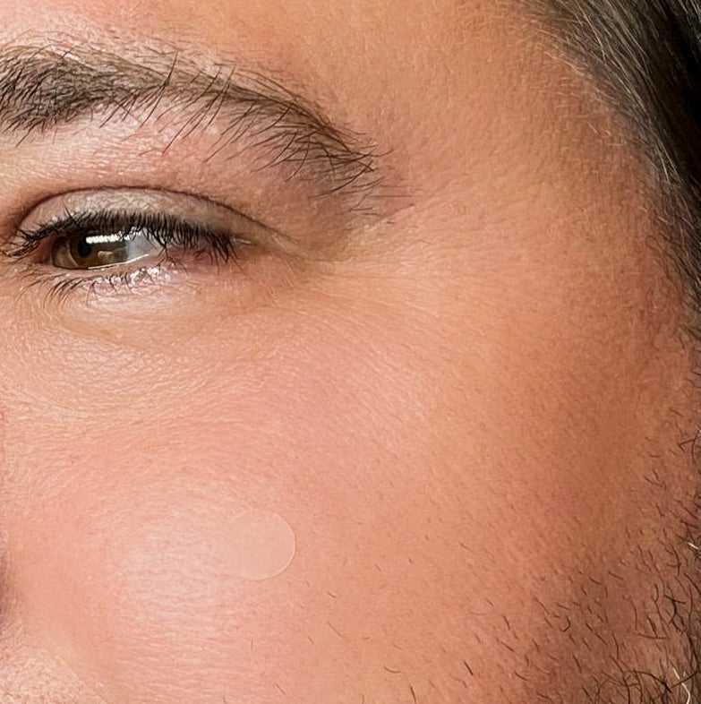 Pimple Patch Multi-Size Pack – 105 Hydrocolloid Patches in 5 Sizes with Tea Tree Oil